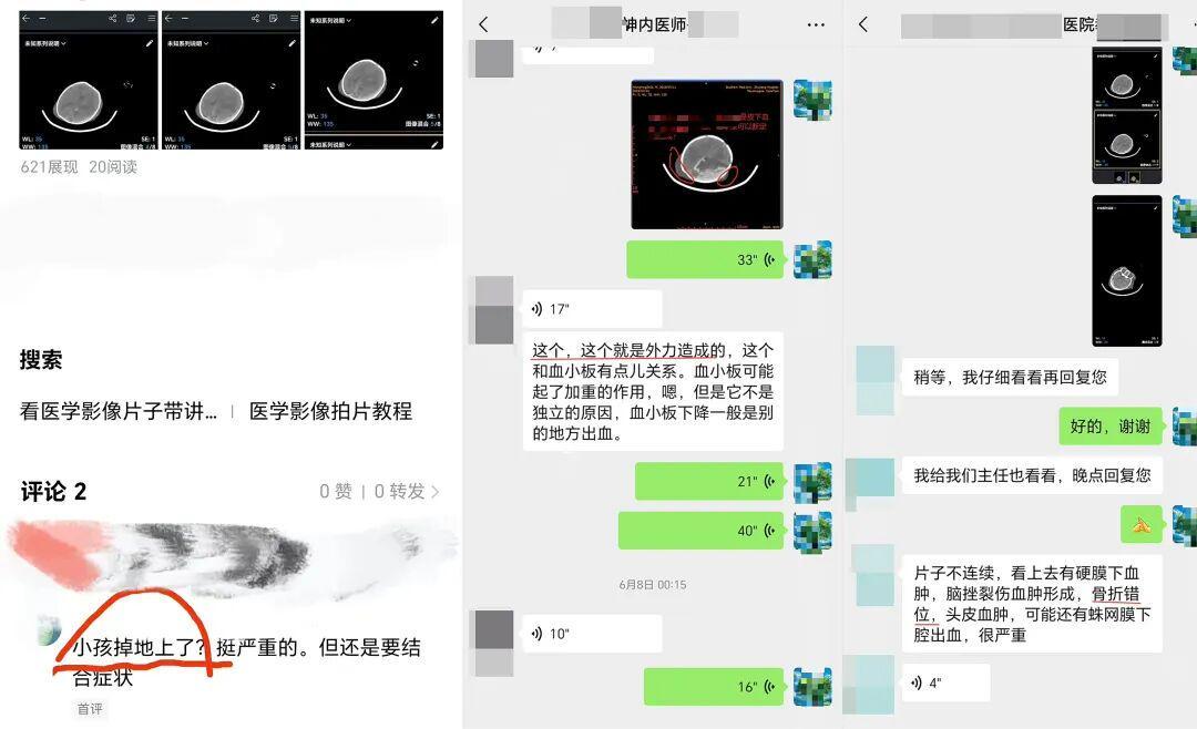 开云体育下载-从“满分新生儿”到7年脑瘫治疗，CT爆真相：孩子出生被摔过头！